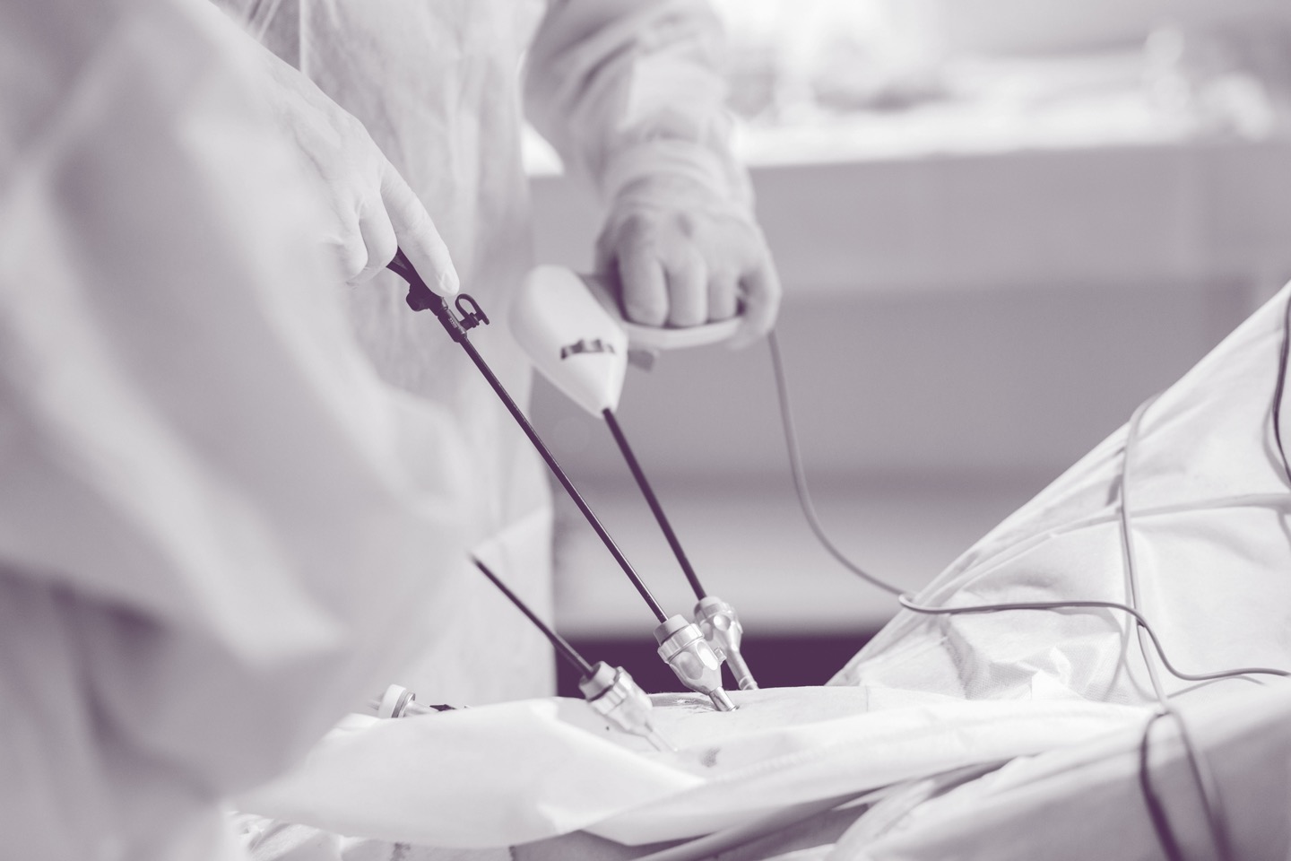 The Importance Of Fully Removing The Appendix During An Appendectomy